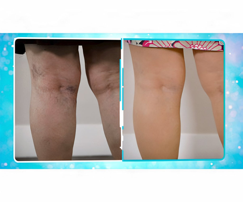 Veins Gone 2x1 a 15.583 HUF